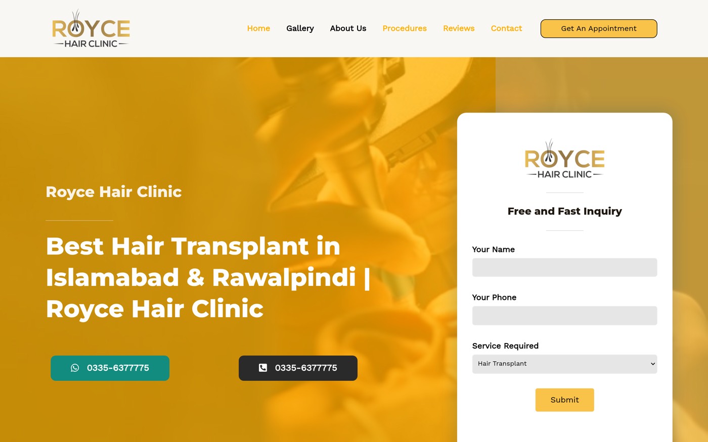 Royce Hair Clinic website — hair transplant